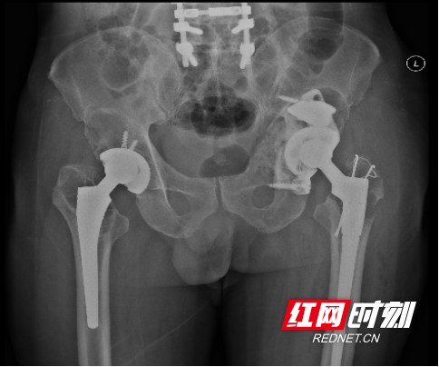 图片3.marked.png
